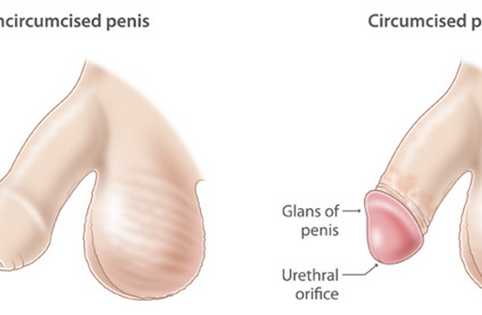 Phimosis Treatment for Tight Foreskin, PULSE CLINIC Singapore