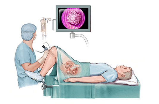 Cystoscopy diagnostic procedure in India : Cost, Hospitals & Doctor