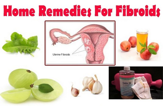 Fibroids