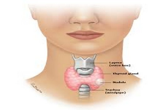 Goiter And Nodular Thyroid Disease treatment in India : Cost, Hospitals ...